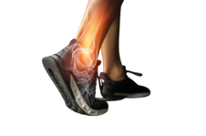 Hip, Ankle, Elbow Arthroscopy