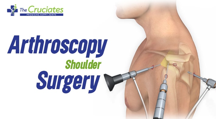 Arthroscopy Shoulder Surgery : Everything You Need to Know