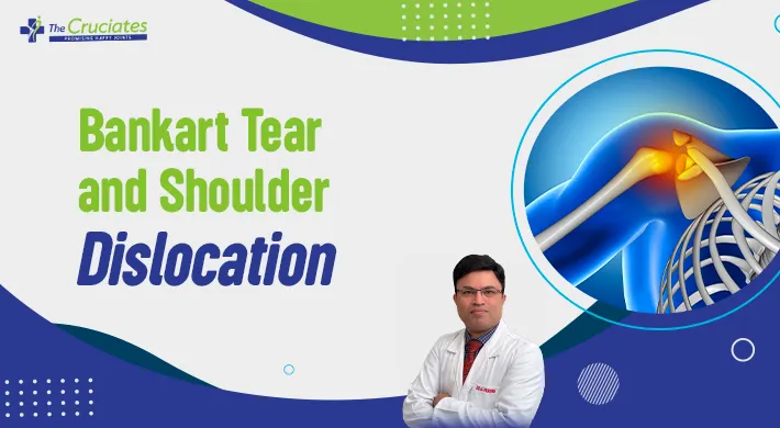 Bankart Tear and Shoulder Dislocation – The Most Common Shoulder Injury